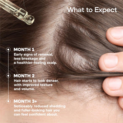 ONYX ProGro LactoPherma application point demonstrates targeted scalp coverage for even distribution.
