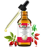 Onznoz Rosehip Oil bottle with dropper for daily facial care.