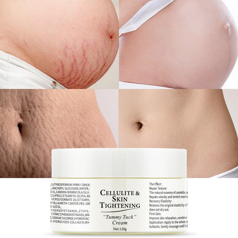 OUPEICHARM stretch marks cream bottle demonstrates hydration and gentle scar care.