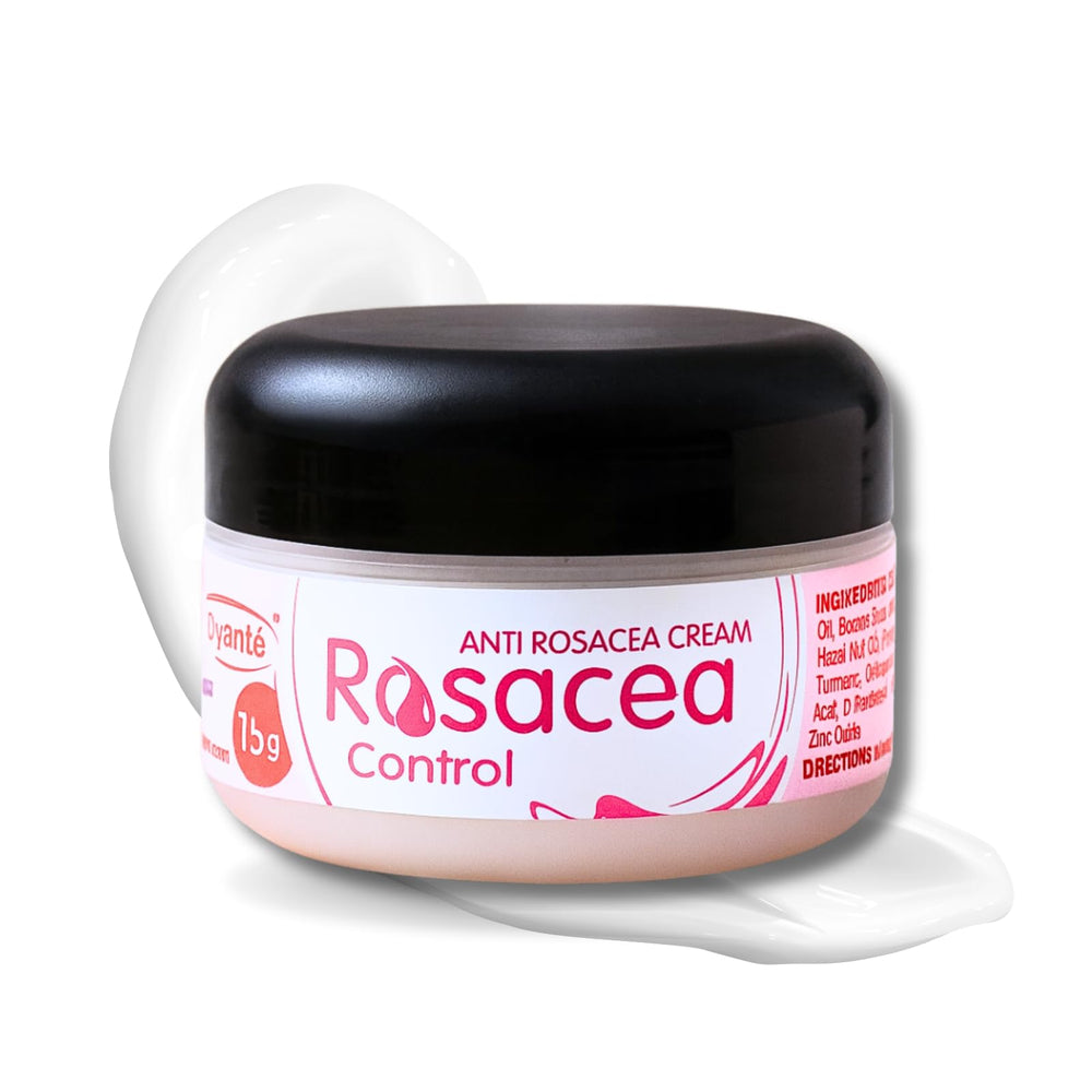 Ovante rosacea cream tube front view for daily redness support