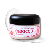 Ovante rosacea cream tube front view for daily redness support