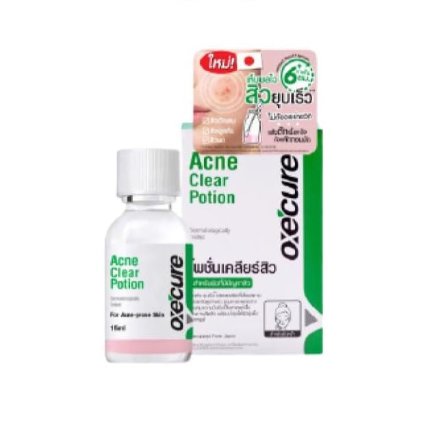 Oxe-cure Acne Clear Potion bottle ready for daily acne care.