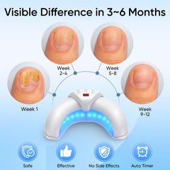 Panimosi surface contact design delivers thorough nail conditioning across nails.