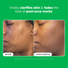 Fragrance-free formula suitable for sensitive skin in real life use.
