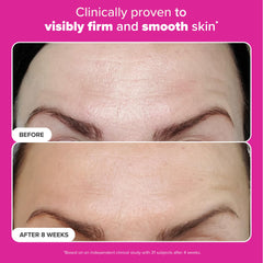 Hyaluronic acid depiction highlighting hydration and plumpness benefits.