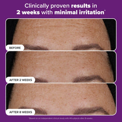 Paula's Choice Pro Retinaldehyde introduces smoother texture and subtle glow.