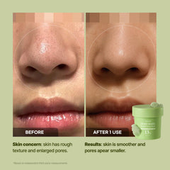 Close-up of P.CALM bubble mask cleansing pores for a refreshed complexion.