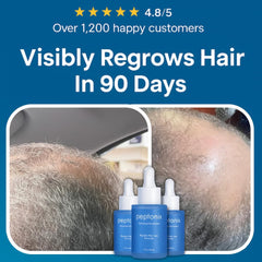 User applying Peptonix copper peptide drops to the scalp