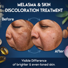 Pharmlitalia Skin Brightening Cream tube suggests radiant glow with gentle formulation.