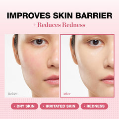 PHYSIOGEL ceramide moisturizer jar highlights barrier support for dry skin.