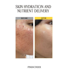 PINKWONDER Jojoba Oil Toner golden oil drop signaling deep hydration