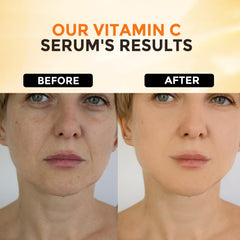 +1HEROLABS Vitamin C Serum application on face and neck for overnight hydration.
