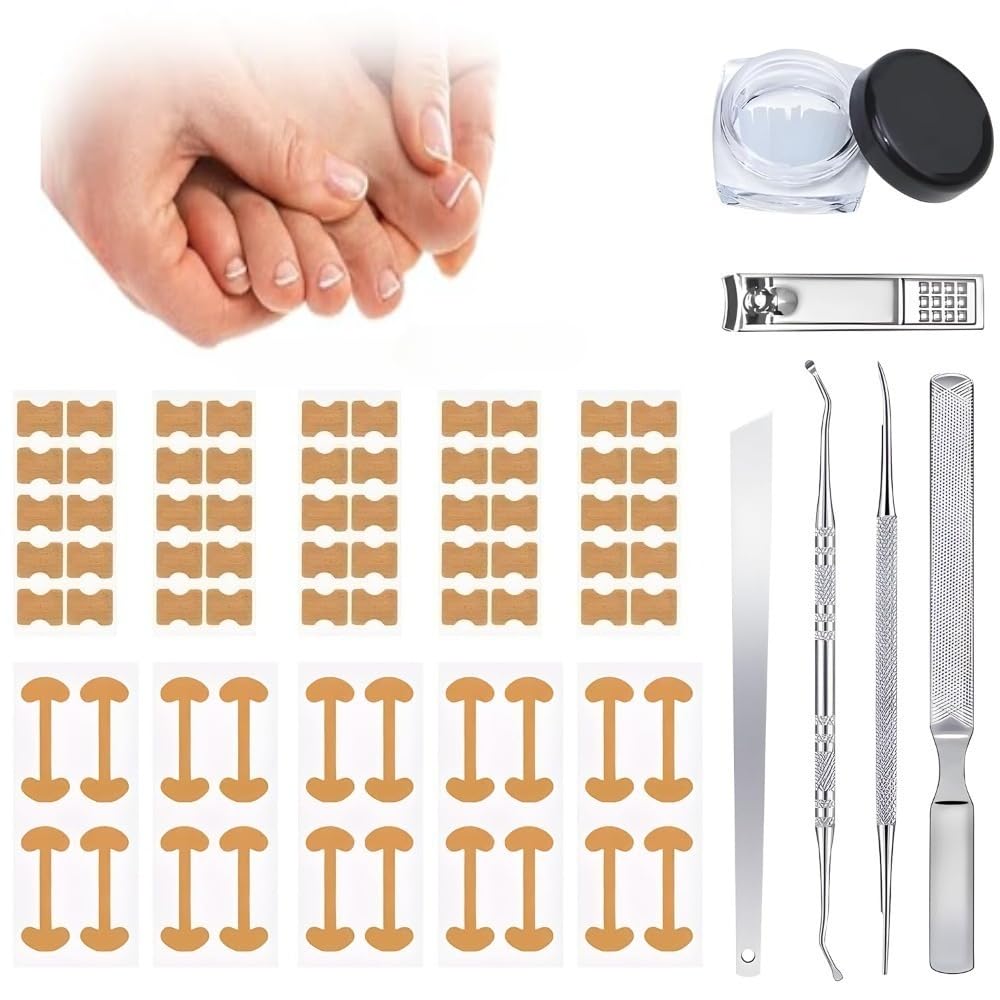 Professional Pedicure Tools ingrown toenail kit corrector strips for breathable, gentle nail guidance