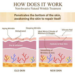 Prypug cheeks and chin patch set for a firmer-feeling complexion overnight