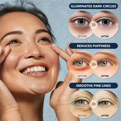 Purederm Deluxe collagen eye patches pack, convenient box for home use.