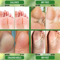 PurOrganica Urea 20% Foot Cream closeup highlighting creamy texture.