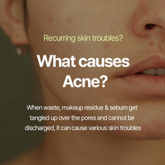 Pyunkang Yul PKY Calming Cleansing Foam tea tree extract close-up, soothing support after cleansing.