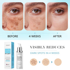 QGGQ packaging image highlights premium serum packaging for hyperpigmentation