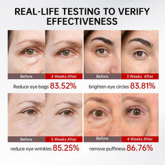 QQE Retinol and Caffeine Eye Serum roller metal tip provides cooling application