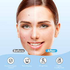 QUSTERE hydrocolloid patch absorbs sebum and fluids while you sleep for overnight improvement