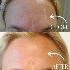 Radical Skincare Age-Defying Exfoliating Pads eye-lip-area-use illustrates gentle, comprehensive coverage