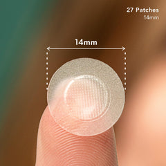 Rael Pimple Patches on skin covering an early blemish for protection.