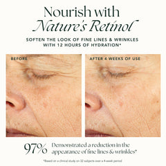RANAV Ashwagandha adaptogen ingredient supports calm, resilient skin