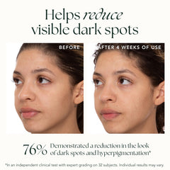 Skin with radiant glow after serum application