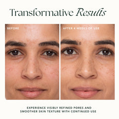 RANAVAT BOTANICS Refining Lotus Gel Cream swirls demonstrating hydration and subtle radiance.