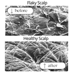 RAUSCH Coltsfoot scalp-care close-up showing soothing action