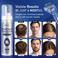 RDVHDLW Minoxidil Foam, rouleau dermo inclus pour préparer le cuir chevelu et favoriser l'absorption