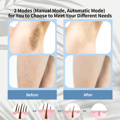 REEOOH skin-sensing technology protects skin during treatment
