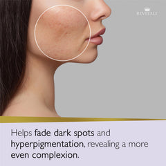 REVITALE sea buckthorn extract illustrating antioxidant protection for hydrated skin