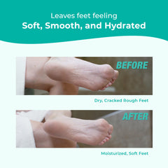 Richenna EZ Foot File used to gently remove dead skin.