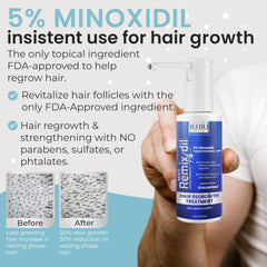 Rida Hair Minoxidil scalp application on thinning areas