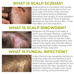 Rida Folliculitis Shampoo foam forms into a gentle lather on scalp.