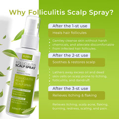 Rida Folliculitis Spray bottle dispensing mist for soothing care.