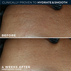 RoC Retinol Correxion Max application demonstrates daily use for wrinkle care