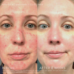 Rodan + Fields Soothe Face Wash texture demonstrates gentle cleansing for comfort.