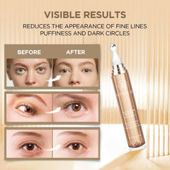 RONKIE ingredient pack showing caffeine and retinol synergy for eye care.