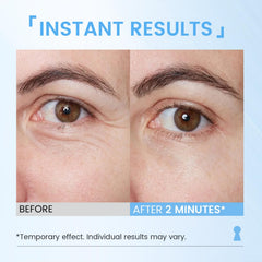 RONKIE eye cream under-eye application showing smoother, brighter skin.