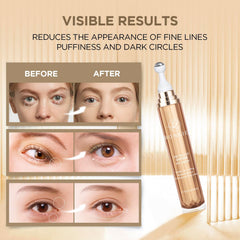 RONKIE eye stick demonstrates smoother-looking under-eye skin.