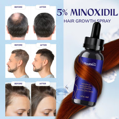 RootStim 5% Minoxidil 2oz bottle angled view emphasizes generous, routine-friendly size.
