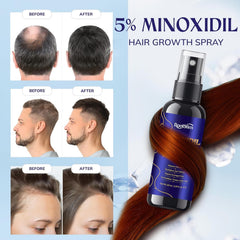RootStim minoxidil rosemary bottle close-up highlighting herbal infusion
