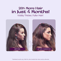 RootStim rosemary and biotin scalp nourishment improves root health.