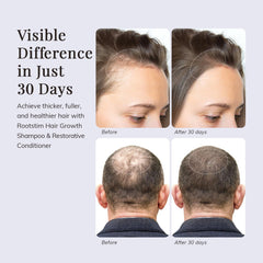 RootStim scalp comfort application demonstrates easy at home massage for a refreshed feel.