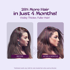 Targeted thinning area being treated with RootStim precision spray