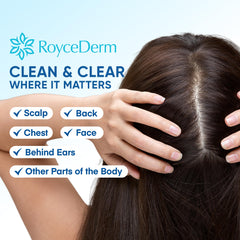 Roycederm ceramide complex diagram highlights barrier-supporting ingredients