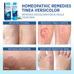 Roycederm tinea treatment label highlights multi-functional antifungal properties for humans