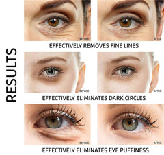 Ruzzut 24K gold eye patches essence closeup shows luxurious shimmer and soothing formula.
